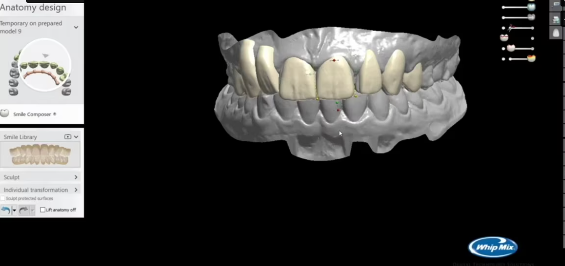 Pakiet 4 nagrań webinarów z okluzji