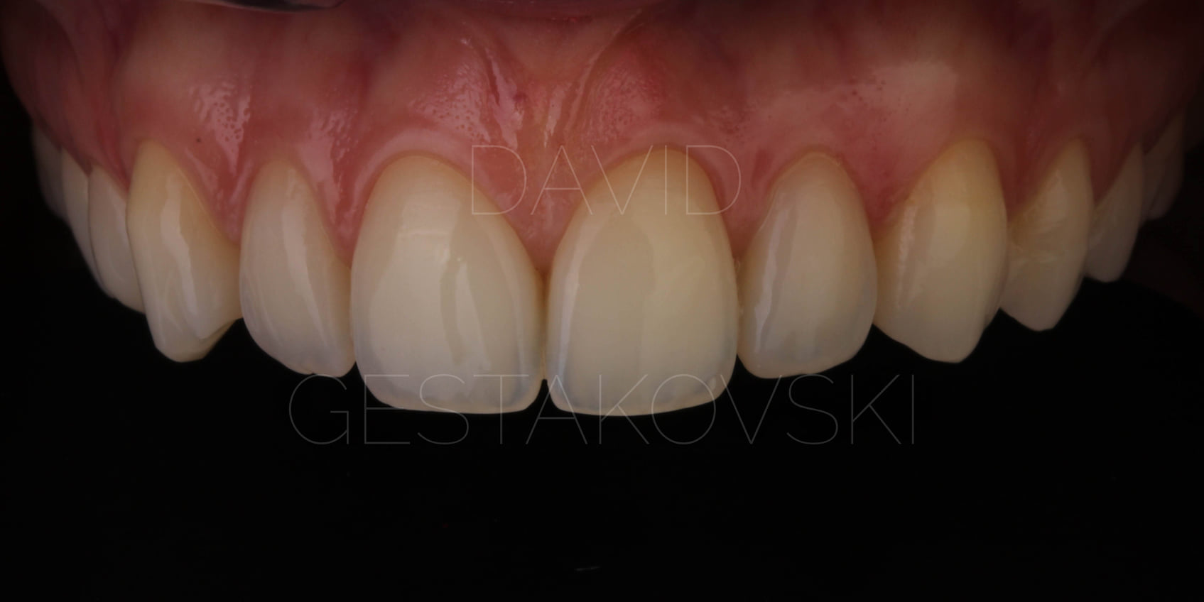 PAKIET 7 WEBINARÓW ZE STOMATOLOGII ESTETYCZNEJ