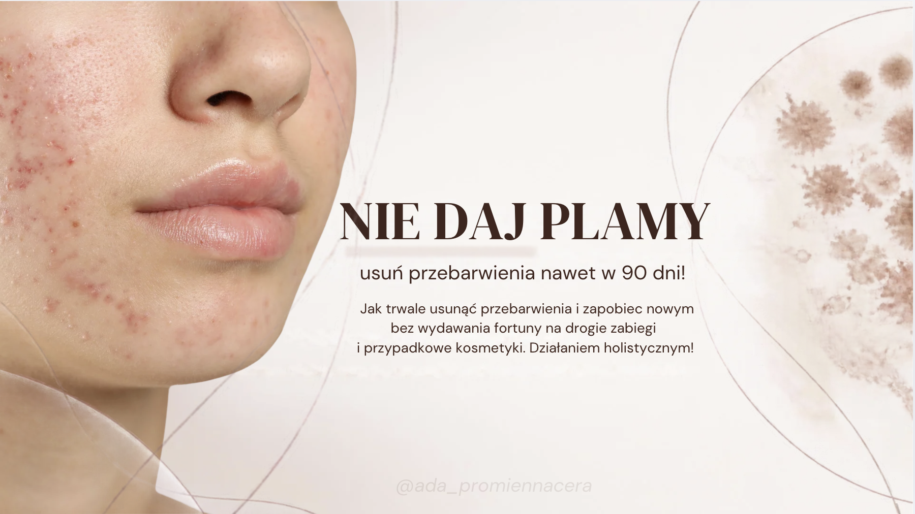 NIE DAJ PLAMY usuń przebarwienia nawet w 90 dni!