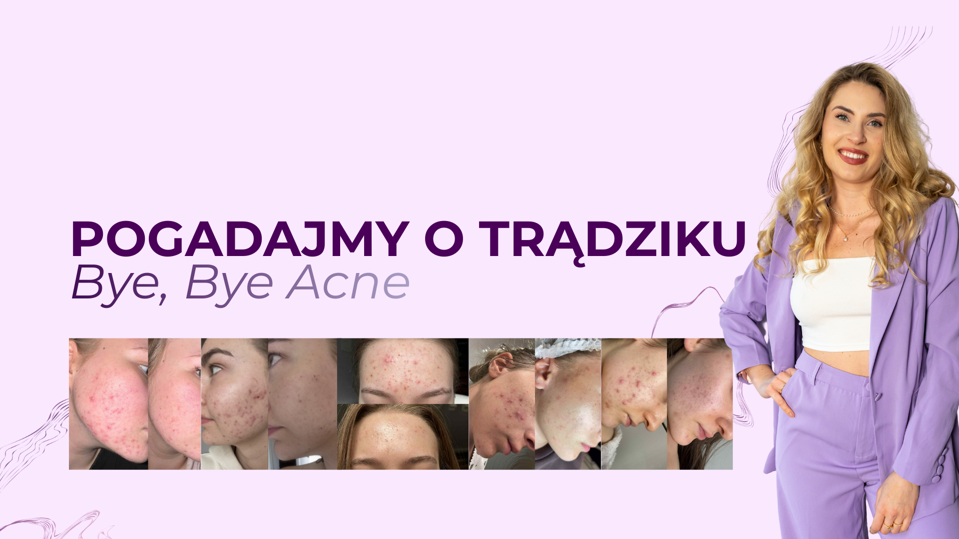 KURS: Bye, bye Acne